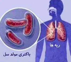 انجام بیماریابی فعال سل در زندان شهرستان مراغه  