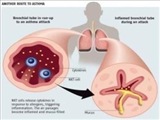 راهنمای کنترل و پیشگیری از آسم ( ویژه پزشکان)